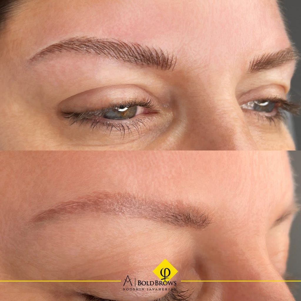 Before vs. After (Microblading) | Canada Makeup | Microblading | photo 2021 11 06 15 24 05 1 | Canada Makeup | NOOSHIN JAVAHERIAN