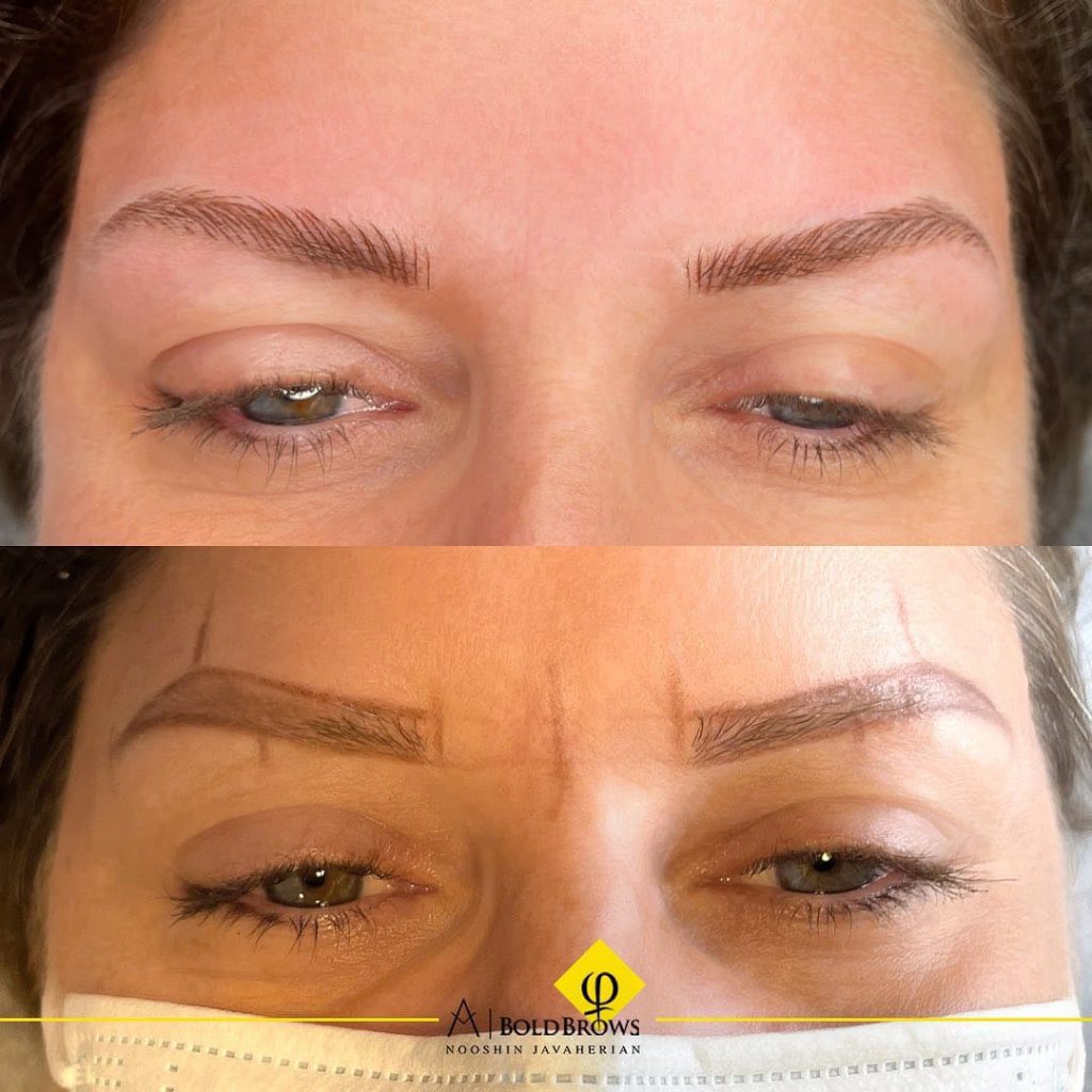 Before vs. After (Microblading) | Canada Makeup | Microblading | photo 2021 11 06 15 24 09 1 | Canada Makeup | NOOSHIN JAVAHERIAN