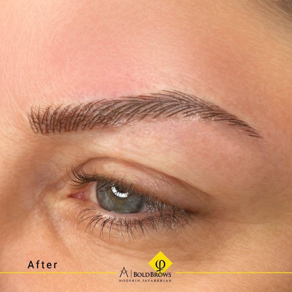 Before vs. After (Microblading) | Canada Makeup | Microblading | photo 2021 11 06 15 24 13 1 | Canada Makeup | NOOSHIN JAVAHERIAN