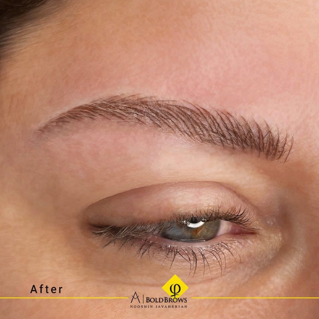 Before vs. After (Microblading) | Canada Makeup | Microblading | photo 2021 11 06 15 24 16 1 | Canada Makeup | NOOSHIN JAVAHERIAN
