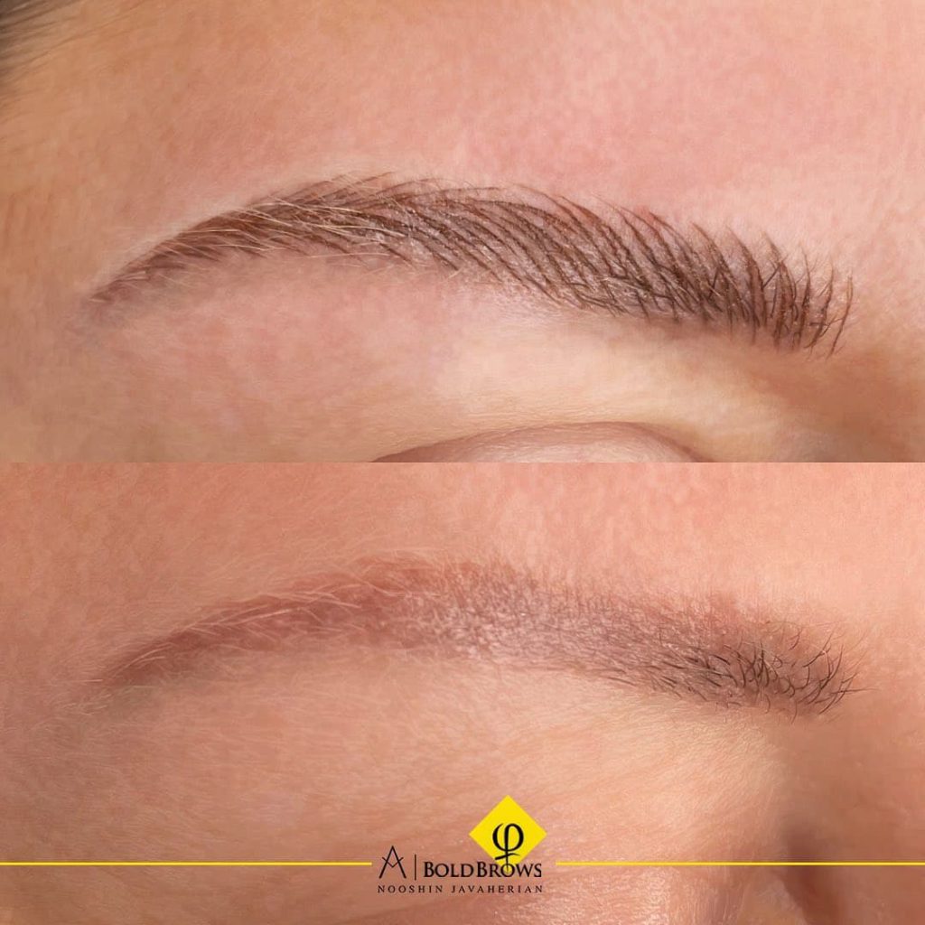 Before vs. After (Microblading) | Canada Makeup | Microblading | photo 2021 11 06 15 24 21 1 | Canada Makeup | NOOSHIN JAVAHERIAN