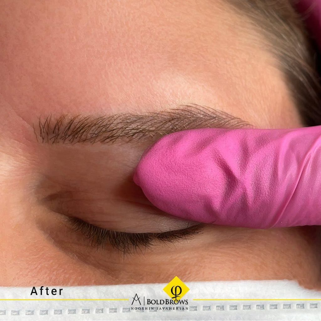 Before vs. After (Microblading) | Canada Makeup | eyebrows | photo 2021 11 06 15 24 27 1 | Canada Makeup | NOOSHIN JAVAHERIAN
