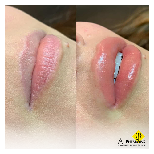 Is the lip blush healing process the same for all styles?