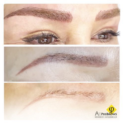 Microblading removal at home​