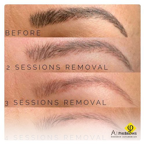 microblading in Toronto