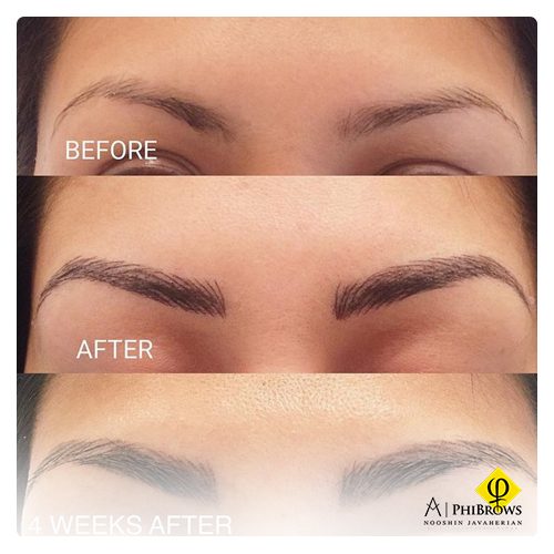 Microblading after 4 weeks  Important Things You Should Know